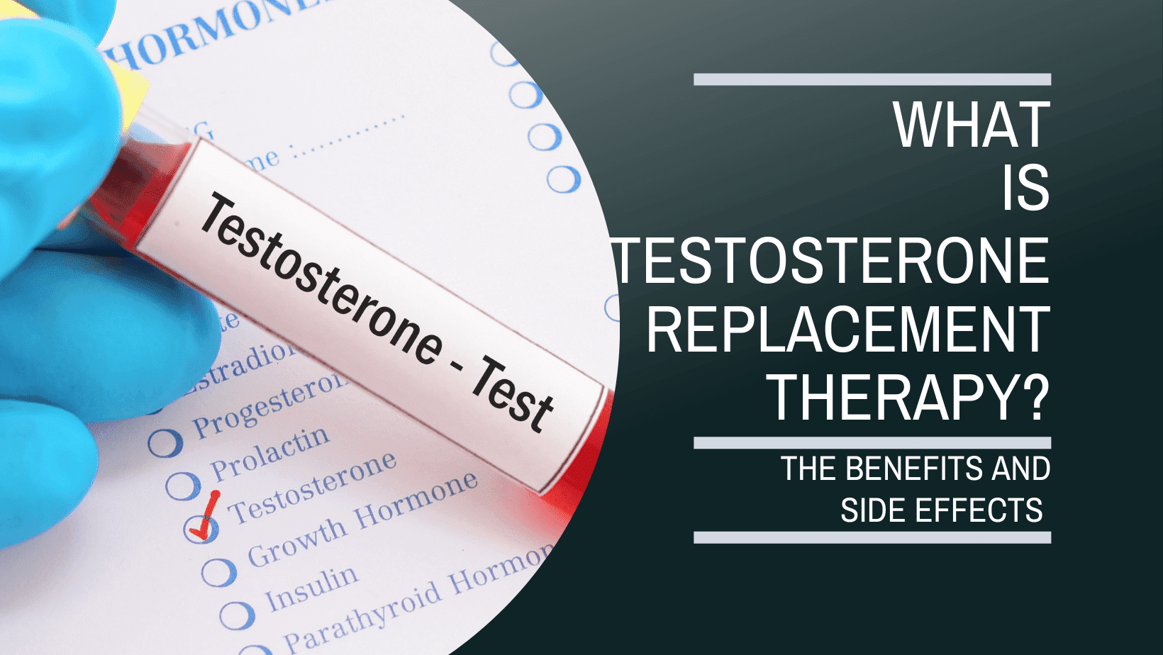 What Is Testosterone Replacement Therapy Nutriwise